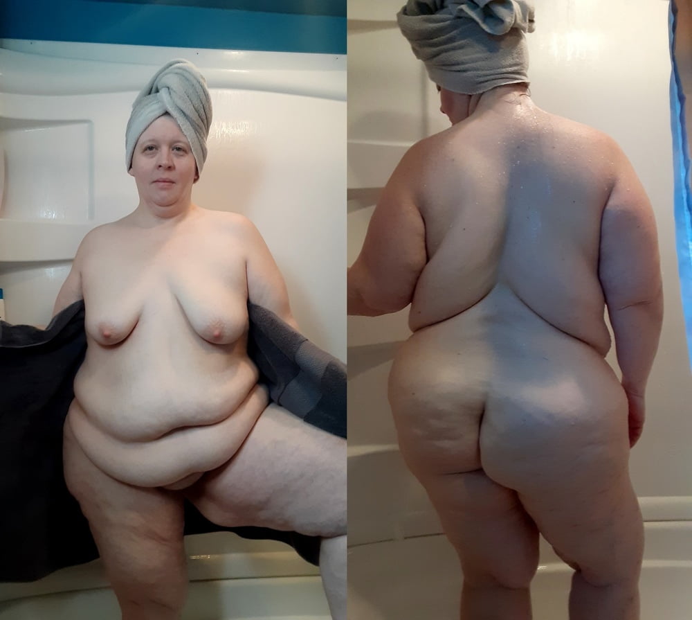 my bbw wife stitched Porn Pics Hd